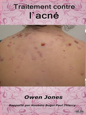 cover image of Traitement contre l'acné